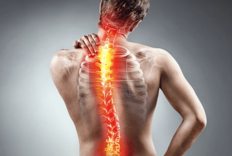 corrector de postura, corrector de postura espalda, corrector de postura mujer, corrector de postura hombre, chaleco corrector de postura, corrector de postura inteligente ¿Cuál es el mejor corrector de postura?